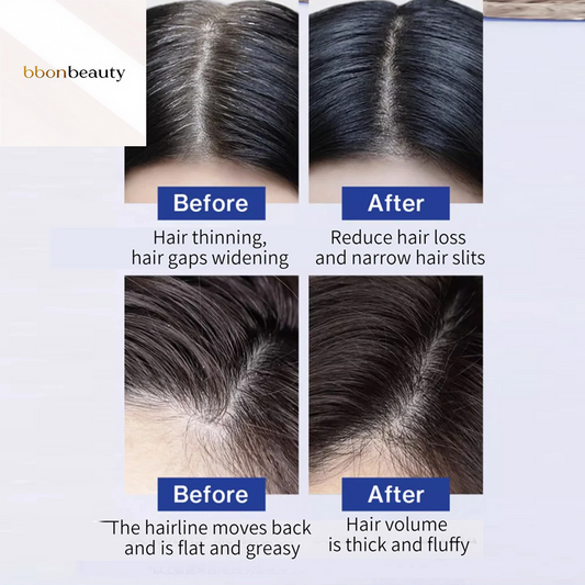 Best Hair Care Product FEG Hair Care Spray Serum for Hair Loss 50Ml